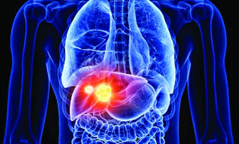 লিভার ভালো ও সুস্থ রাখার উপায়