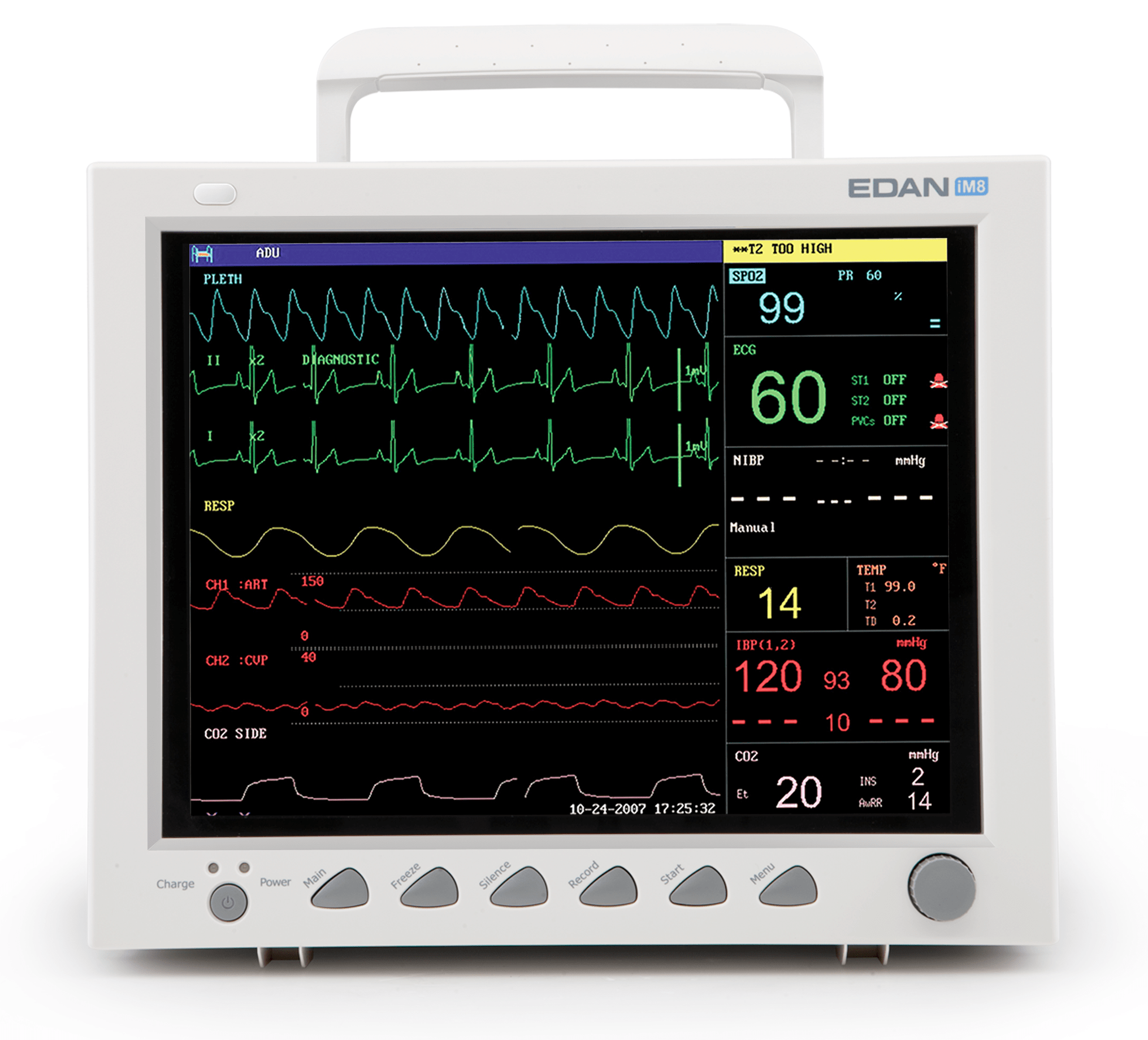 Edan iM8 Patient Monitor